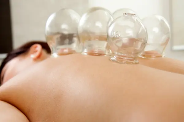 Oil, Cupping and Herbal Ball Compress Massage